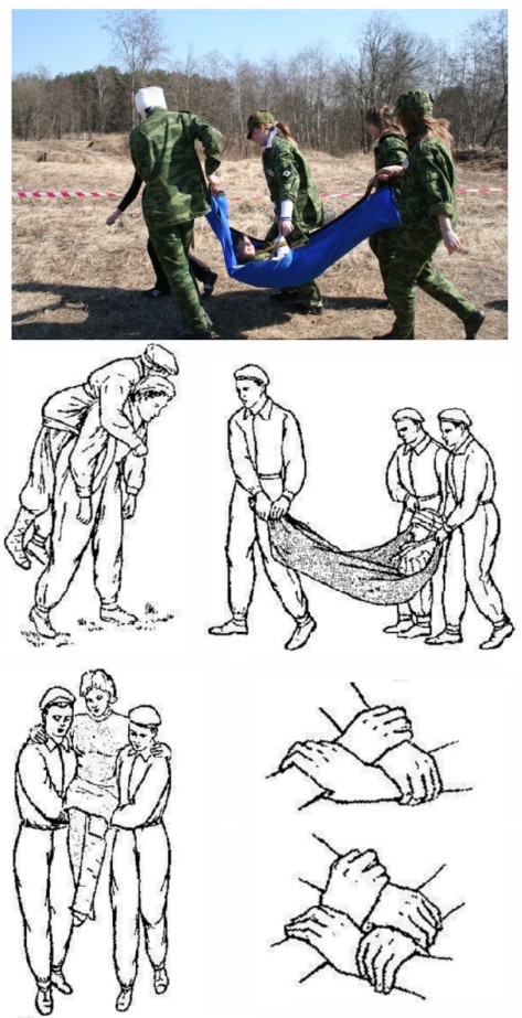Способы транспортировки пораженного